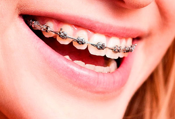 brackets brackets