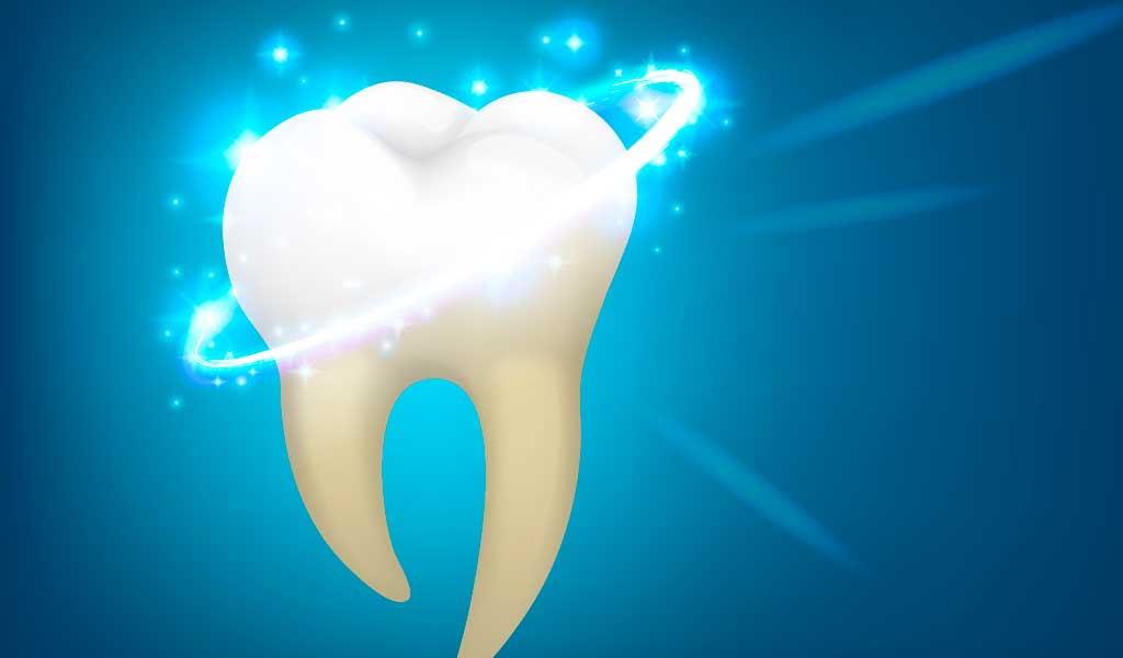 Remineralización de lesiones de caries Iniciales